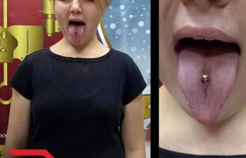 Фото