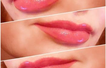 Фото