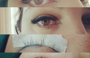 Фото