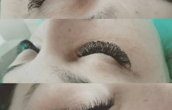 Фото