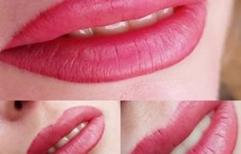 Фото