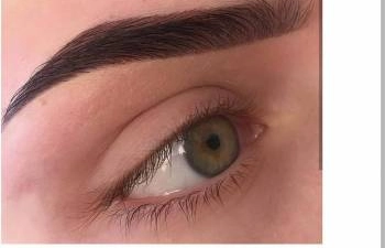 Фото
