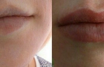 Фото