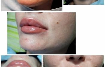 Фото