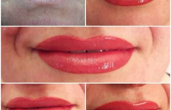 Фото