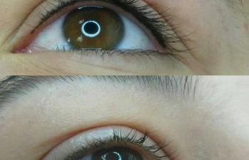 Фото