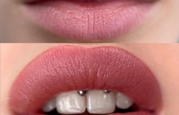 Фото