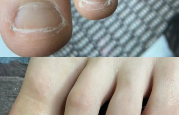 Фото