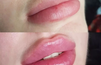 Фото