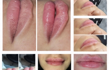 Фото