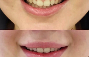 Фото