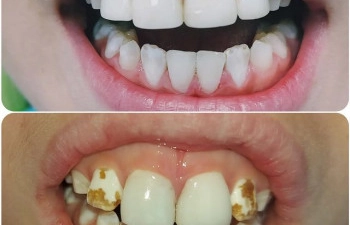 Фото