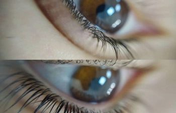 Фото