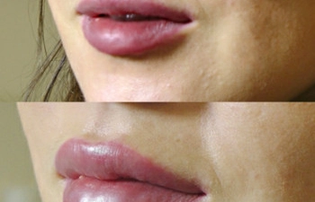 Фото