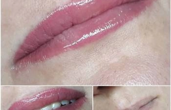 Фото