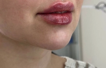 Фото