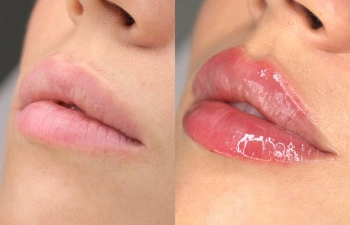 Фото