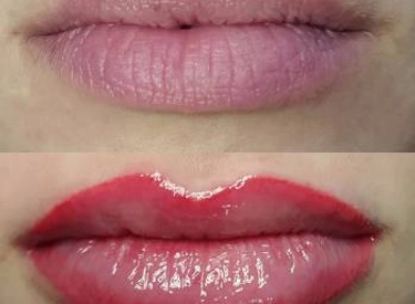 Фото