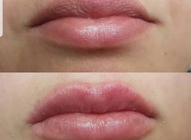 Фото