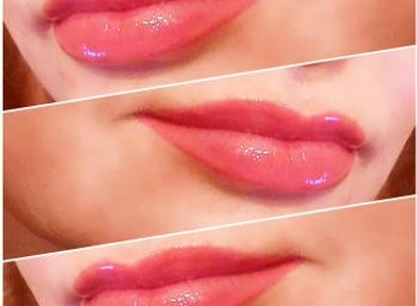 Фото
