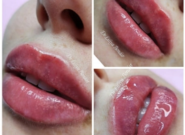 Фото