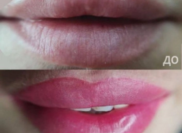 Фото