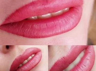 Фото