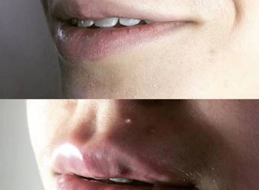 Фото