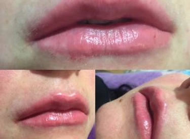 Фото