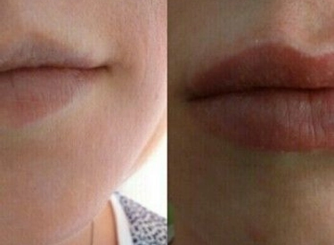 Фото