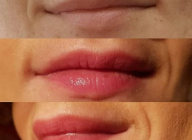 Фото