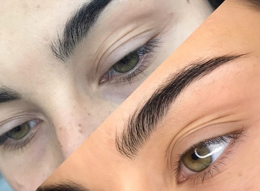 Фото