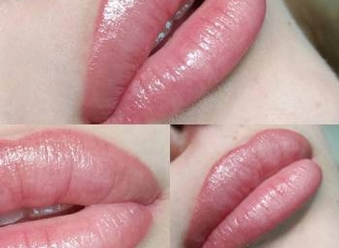 Фото