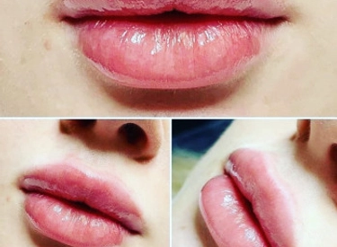 Фото