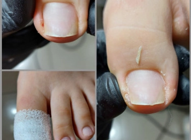 Фото