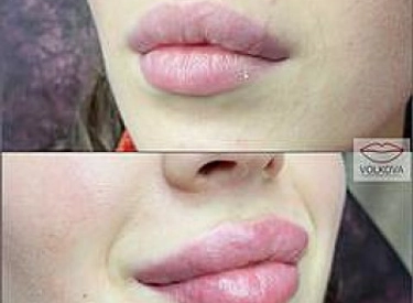 Фото