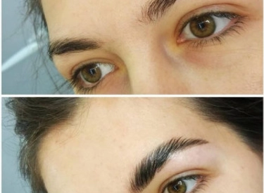 Фото