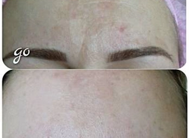 Фото
