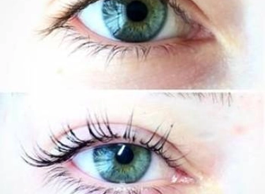 Фото