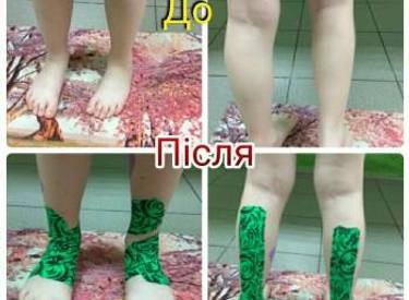 Фото