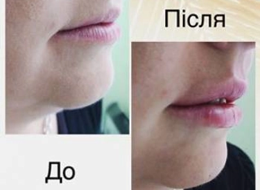 Фото