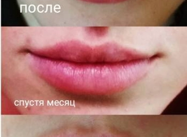 Фото
