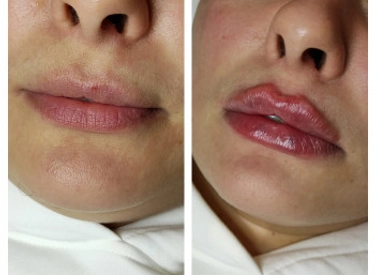 Фото