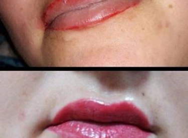 Фото