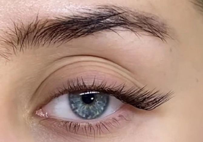 Фото