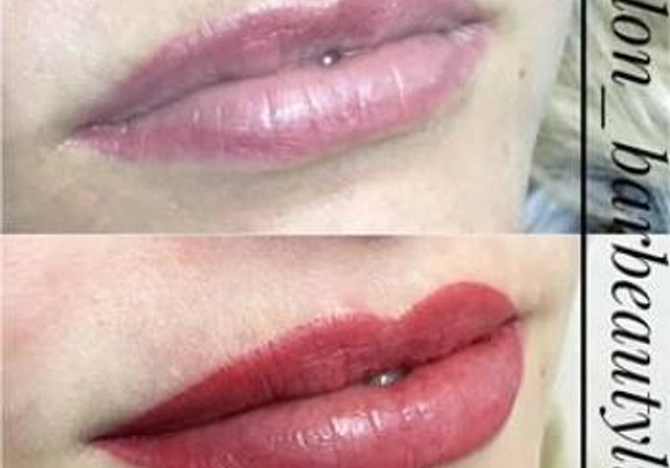 Фото