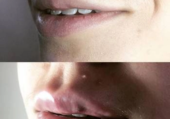 Фото
