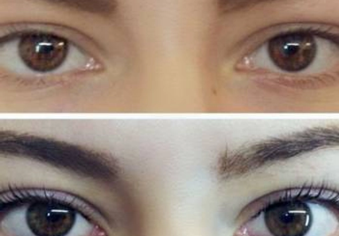 Фото