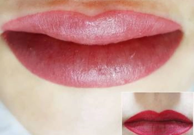 Фото