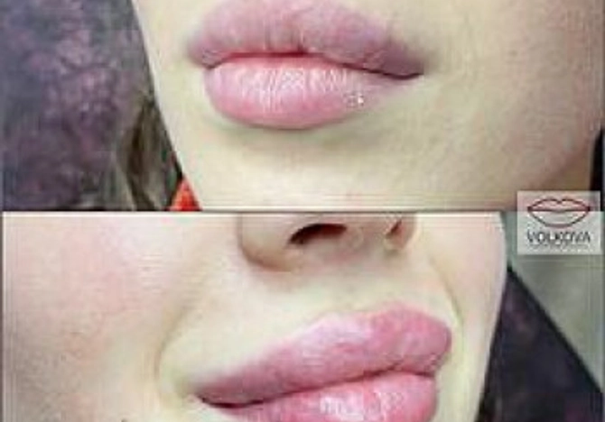 Фото